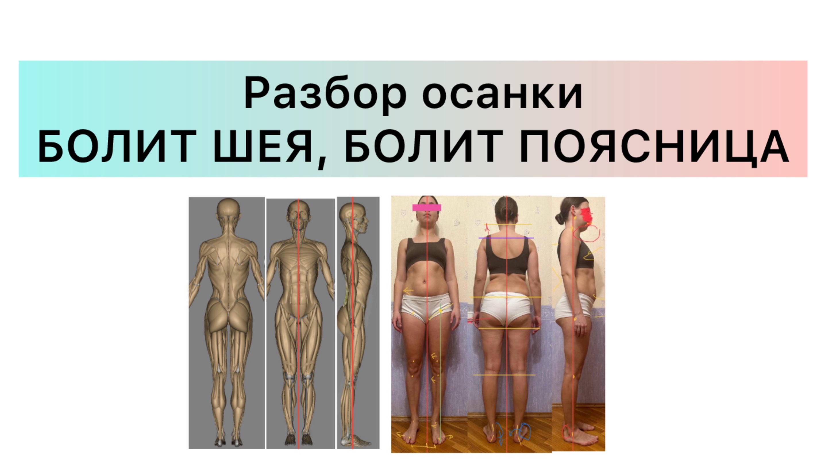 Болит шея, болит поясница, причины. Почему болит поясница долго сидеть