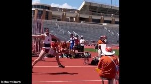 Случаи о которых можно смело сказать «один на миллион»