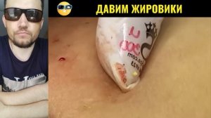 ТЩАТЕЛЬНАЯ ЧИСТКА ЛИЦА #27