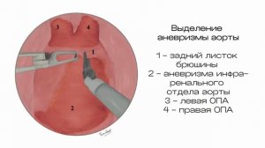 Интервью с сосудистыми хирургами ККБ №1 об атласе по р