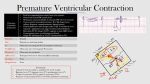 53.Premature Ventricular Contraction