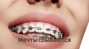 Главное идти к своей мечте
