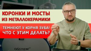 Не спешите менять коронки и мосты из металлокерамики на такие же!