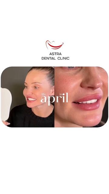 Как прошёл апрель в Astra Dental Clinic #стоматолог #доктор #гру смотреть онлайн