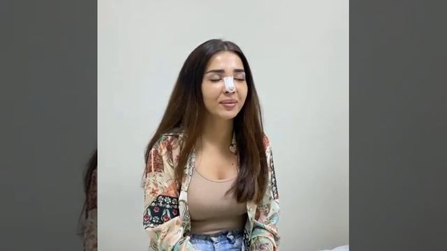 Rhinoplasty . dr_Sanan_Mehdiyev . закрытая ринопластика .  первые впе?