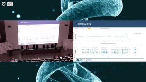 Анализ CNV по данным экзомного секвенирования. Рогачева М.С.