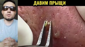 ЧИСТКА ЛИЦА #6