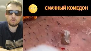 СМАЧНЫЕ сальные пробки №19