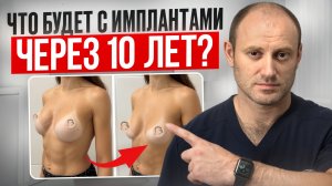 ВСЯ ПРАВДА ОБ ИМПЛАНТАХ / Что на самом деле происходит в вашем теле?