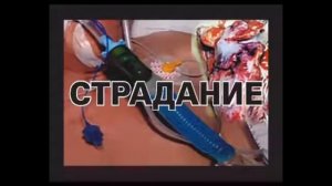 Всемирный день без табака