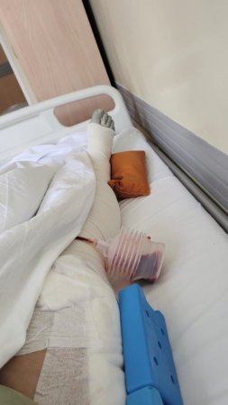 #Операция на #тазобедренныйсустав