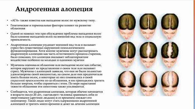 Алексей Мелехин Психосоматика алопеции
