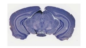 Разбор заданий ЗЭ 2019   Клеточная биология и гистология   9 класс