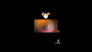 1000003448.mp4