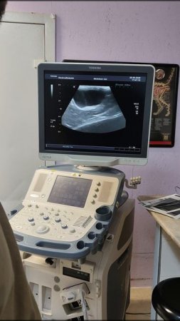 УЗИ диагностика мочевыделительной системы в "Доктор Пух"