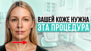 От ЭТИХ процедур эффект омоложения ЗАМЕТЕН СРАЗУ! Какую технологию омоложения выбрать в 2025?