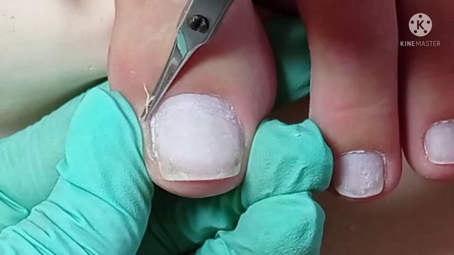 #педикюр_ без обработки стоп_##видео-потеряшка(( смотреть онлайн