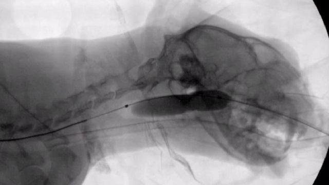 Стеноз носоглотки у кота со стертором, баллонная дила? смотреть онлайн