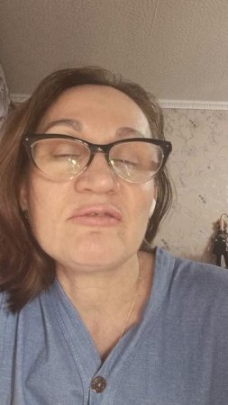 Альбина