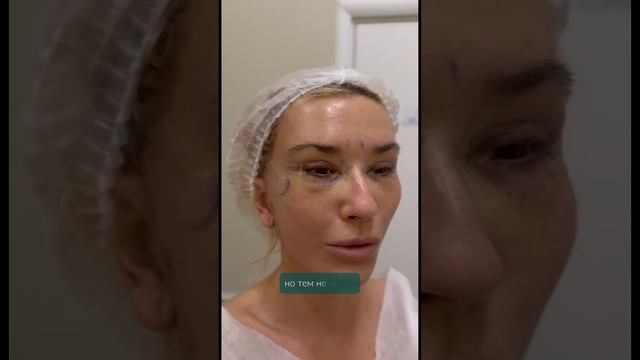 Комплексное омоложение, разбор случая смотреть онлайн