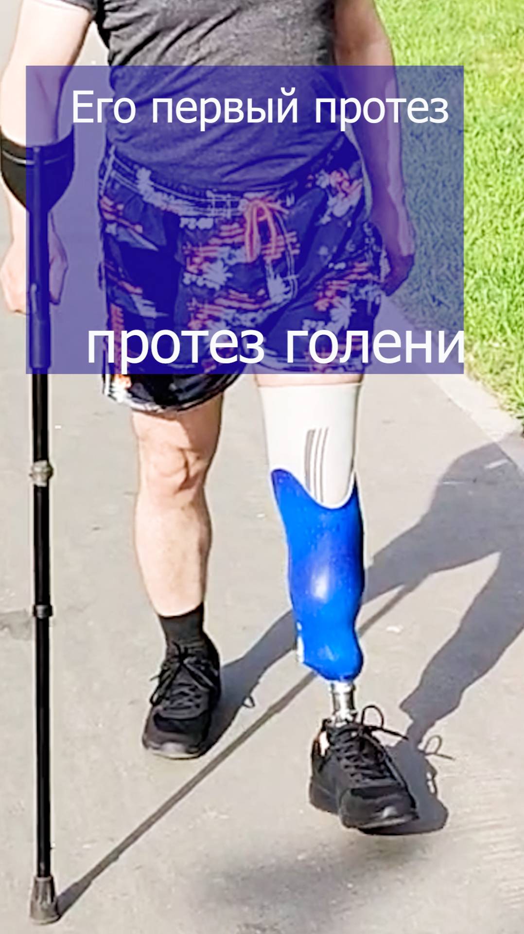 Первые шаги на протезе голени