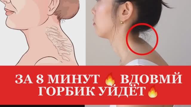 Как убрать ВДОВИЙ ГОРБ за 8 МИНУТ 🔥в день ДОМА? / ВОЛШЕБНЫЕ упражнения от ХОЛКИ на ШЕЕ!#спорт