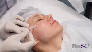 04. Нити MONO. Лифтинг Full Face в 4 этапа нитями различных мод?