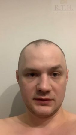 До и после пересадки