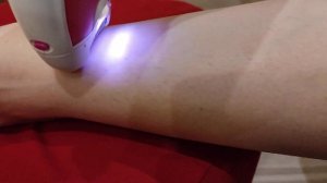 Демонстрация работы эпилятора Vitek VT-2244