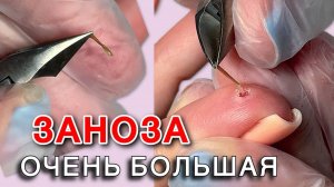 Заноза