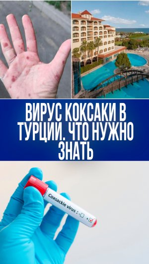 Вирус Коксаки атакует туристов в Турции: менингит – реальная угроза!