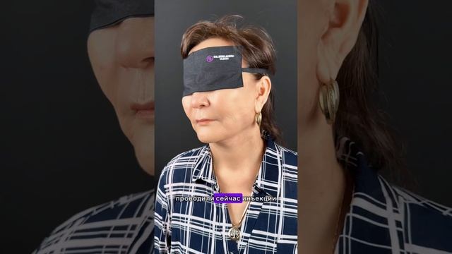 круговая блефаропластика; смас подтяжка; платизмопла?