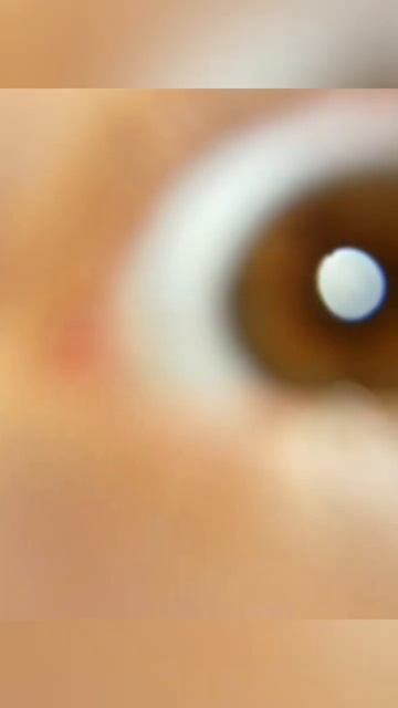 🧏♂️-у тебя карие глаза? 💁♀️ #eyes #wateryeyes #eyecolor #рек? смотреть онлайн