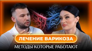 Варикоз: правда, о которой вы не знали | подкаст с сосудистым хирургом Сергеем Луговским
