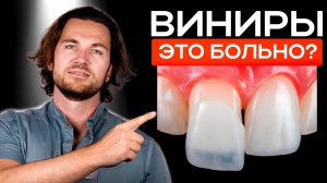 ВИНИРЫ / Что такое виниры, на сколько они практичны и кому подходят?