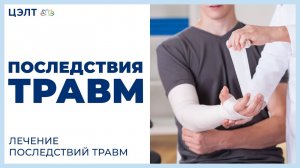 ♿ Последствия травм. Лечение последствий травм. ЦЭЛТ.