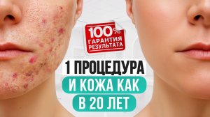 Почему НЕЛЬЗЯ чистить зубы до блеска? #зубы #гигена #чистказубов