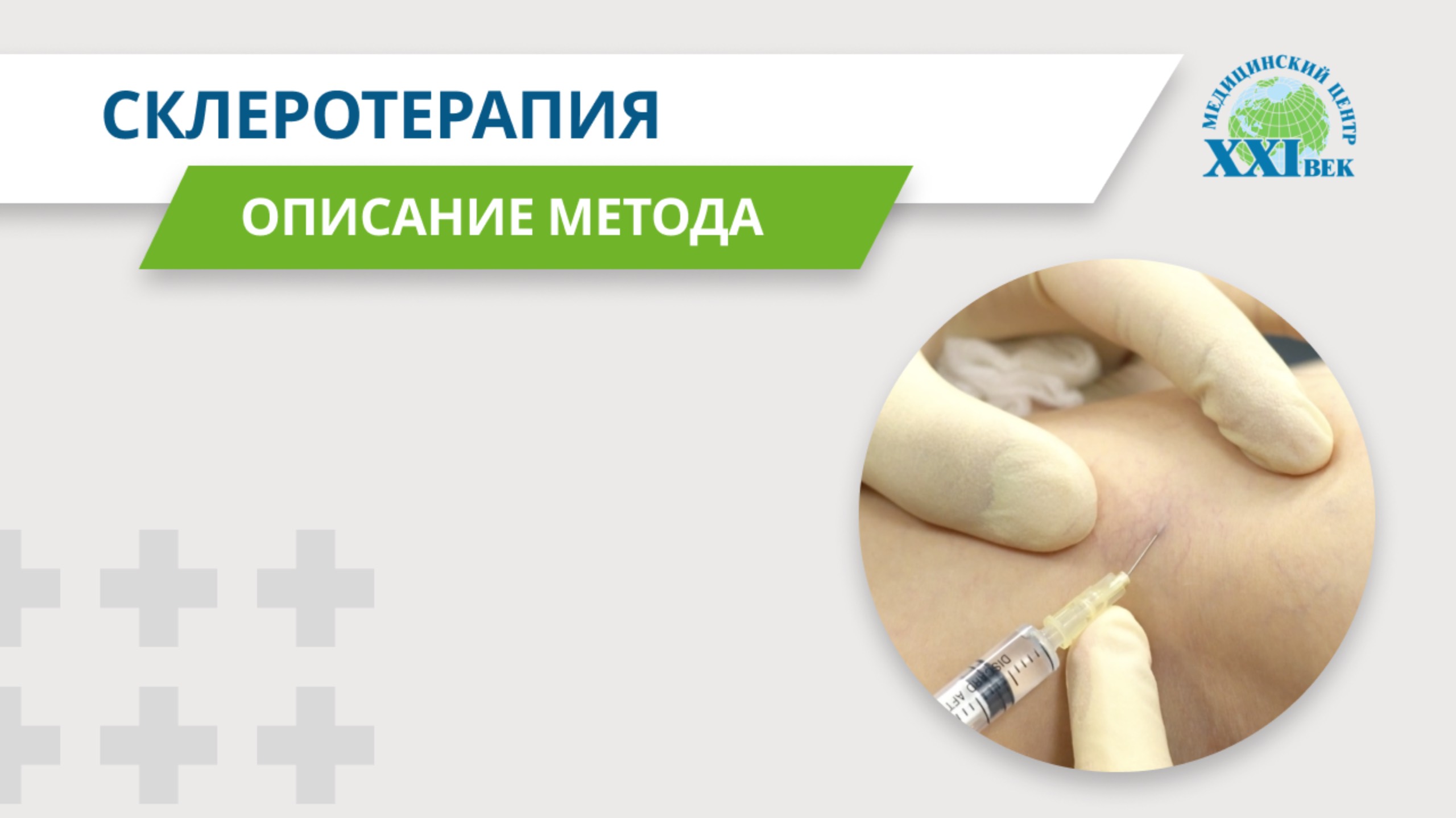 Склеротерапия: лечение варикоза и сосудистых звездочек | Медицинский центр XXI век
