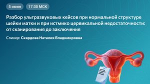 Вебинар: УЗИ шейки матки при ИЦН и норме - разбор кейсов!