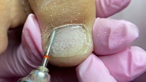 ЖУТКИЕ ПРОПИЛЫ ногтевой пластины! Как исправить?