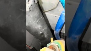 Демонтаж врезок полотенцесушителя в труднодоступном