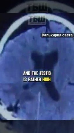 VID_20250228_123517_288.mp4