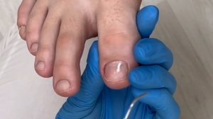 Установка жидкой тампонады и стабилизационной систем