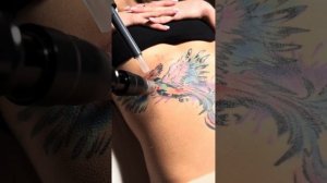 Начали удаление сложной цветной татуировки, в процесс