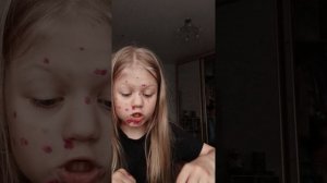 УКОЛ ДЛЯ ЛЕЧЕНИЕ СПИНЫ💉💉 МАССАЖ СПИНЫ🤙🤙😁