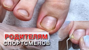 ГИМНАСТИКА