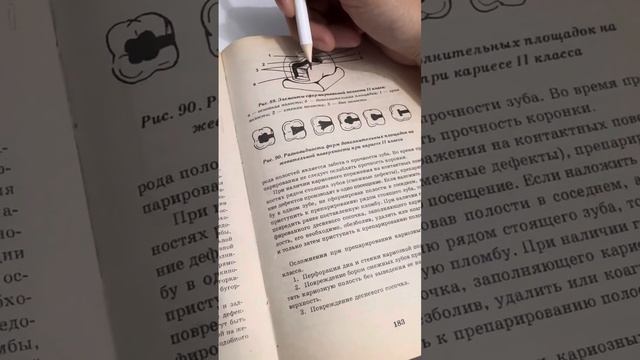 Препарирование 2 класс по Блэку смотреть онлайн