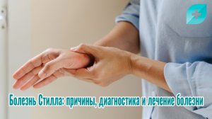 Болезнь Стилла: причины, диагностика и лечение болезни