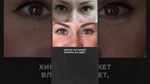 Как убрать синяки под глазами?!? 🤩🤯 #липофилинг #синякиподглазами