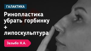 Трое детей и новое “я”: ринопластика + липоскульптура от Николая Зазыбо